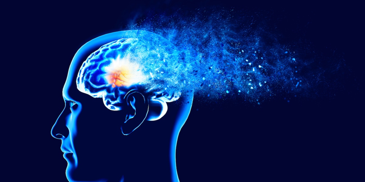 Neue Warnsignale - Das passiert im Gehirn, 20 Jahre bevor Alzheimer